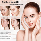 18FTRabbit 7-Color LED Face Mask Light Therapy – Model FM-01, Skin Care Mask for Face and Neck