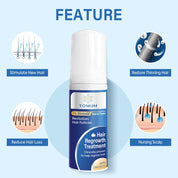 5% Minoxidil Foam for Hair Growth & Regrowth – Slows Hair Loss, Promotes Thicker, Longer Hair – 2 Month Supply