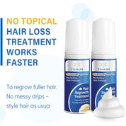 5% Minoxidil Foam for Hair Growth & Regrowth – Slows Hair Loss, Promotes Thicker, Longer Hair – 2 Month Supply